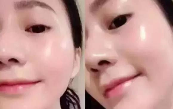 NEW&NEW告诉你不用敷面膜也能拥有水光肌的秘密！