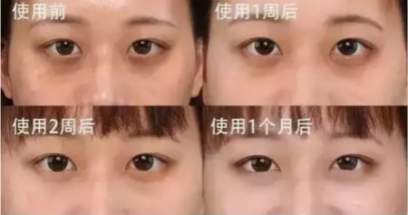 眼部护理知多少？你离神采奕奕，其实只差一个眼部“小熨斗”