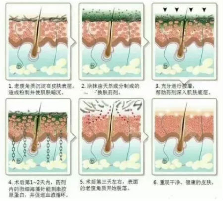 NEWNEW|修复痘坑痘印还得靠海藻焕肤