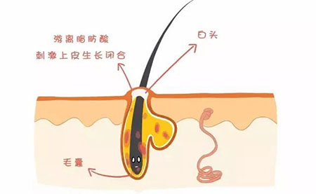 “闭口”这个磨人的小妖精又出来作妖啦！