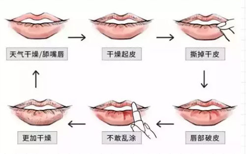 谁说夏天不用护唇膏?没有它，再贵的口红都没用!