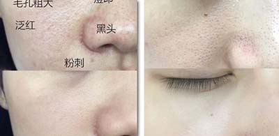 0创智能美肤美容仪的原理是什么_幸福是什么图片