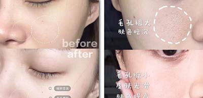 0创智能美肤美容仪的原理是什么_幸福是什么图片