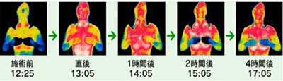 一次减3~6公分，塑形就选高周频溶脂瘦身管理