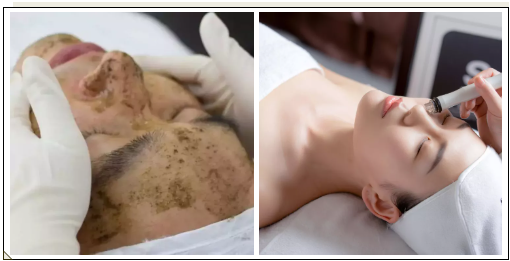 VN美肤经:定期做皮肤管理的好处,值得每个人收藏!