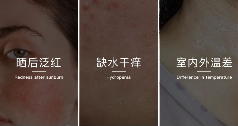 无惧时光,天生优雅,敏感肌&受损肌的修护“膜”法